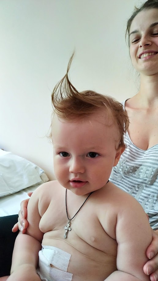 Our son woke up crying uncontrollably after returning from the UK via Italy; rushed for emergency surgery for invagination (intussusception), discovering a Meckel's diverticulum.